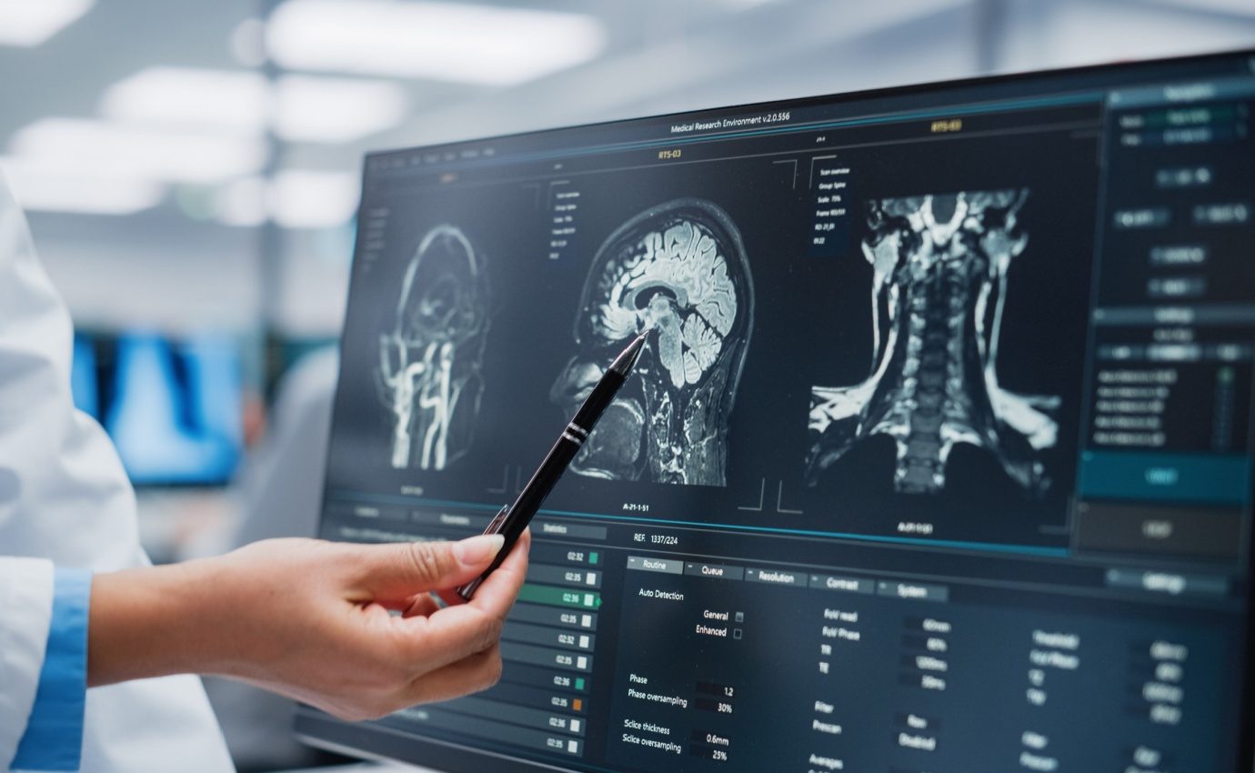 Ein Arzt zeigt auf einen MRT-Scan des menschlichen Gehirns auf einem hochmodernen Computerbildschirm. Der Artikel untersucht die potenziellen Vorteile von Heilpflanzen wie Kurkuma bei der Prävention und Behandlung neurodegenerativer Erkrankungen.